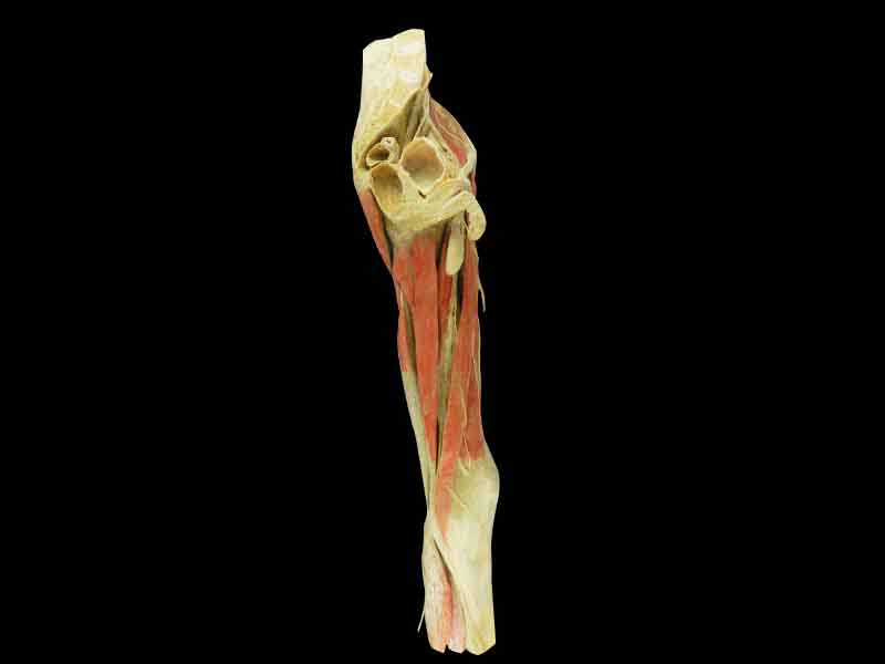 25cm  hip-mid leg specimen