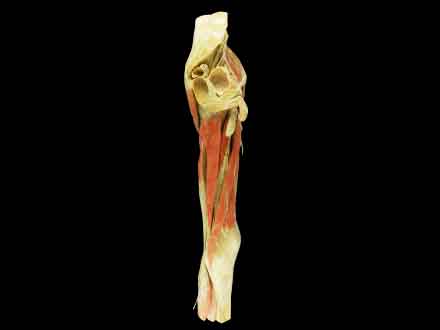 25cm  hip-mid leg