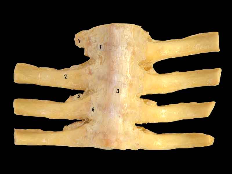 articulationes costovertebrales anatomy specimen