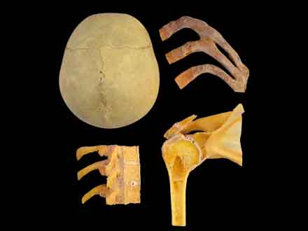 classification of bone union specimen