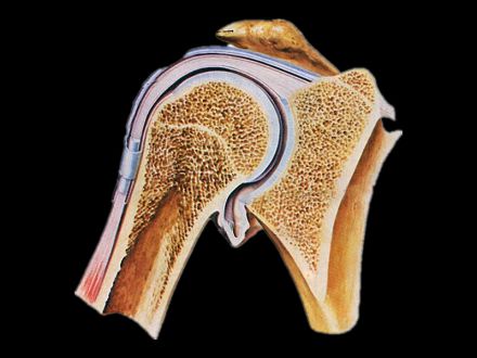 Coronal section of shoulder plastinated specimens( plastinated cadavers )