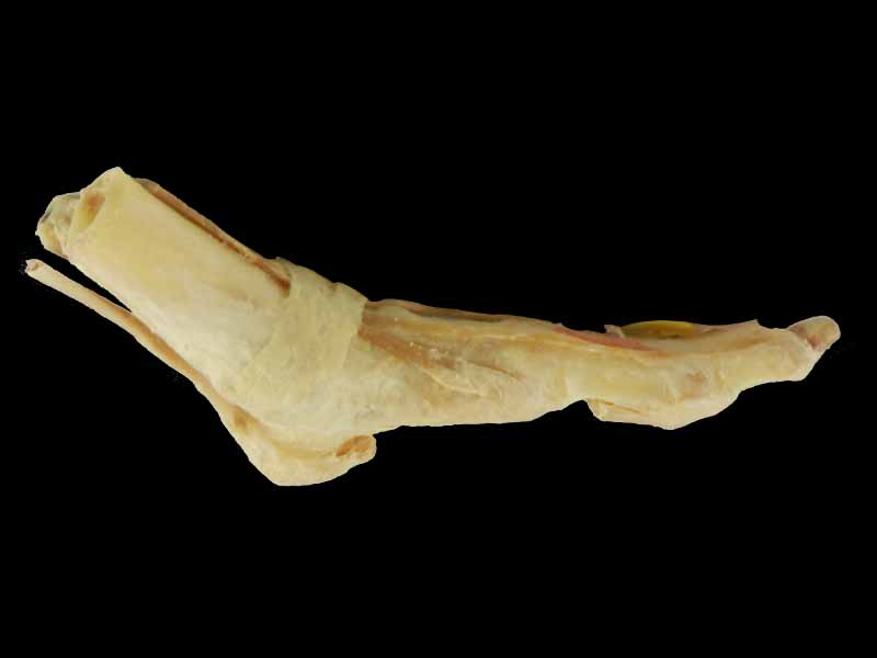 deep muscle of foot plastinated specimen
