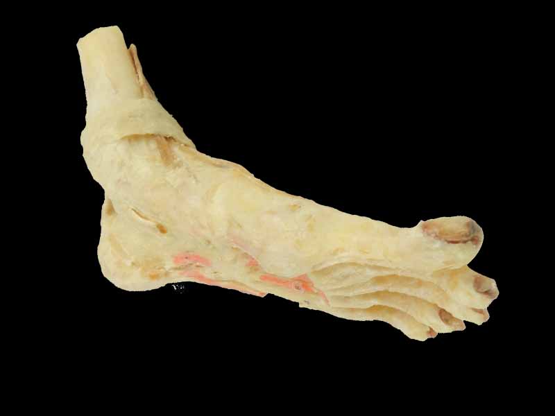 deep muscle of foot plastination