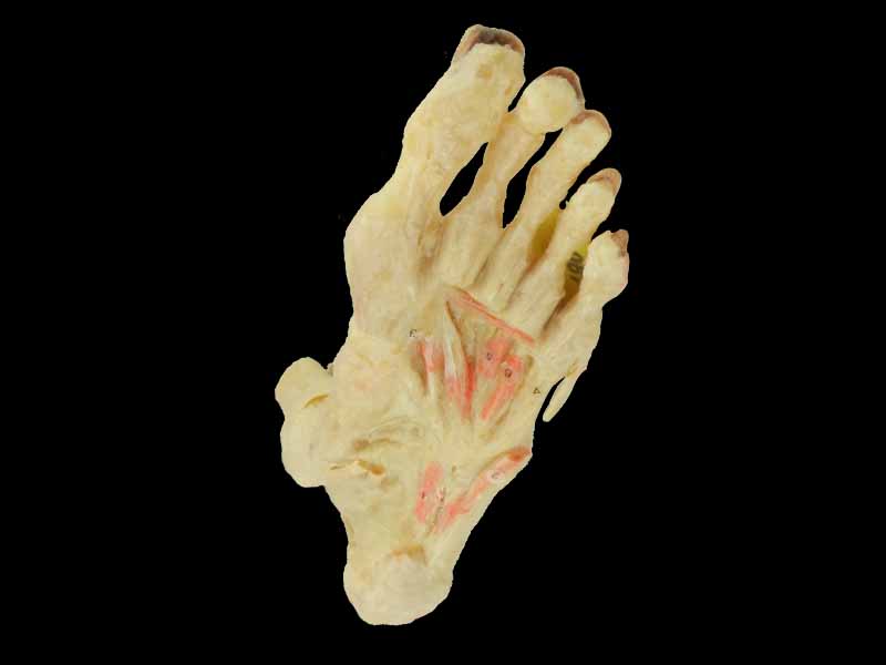 deep muscle of foot specimen for sale
