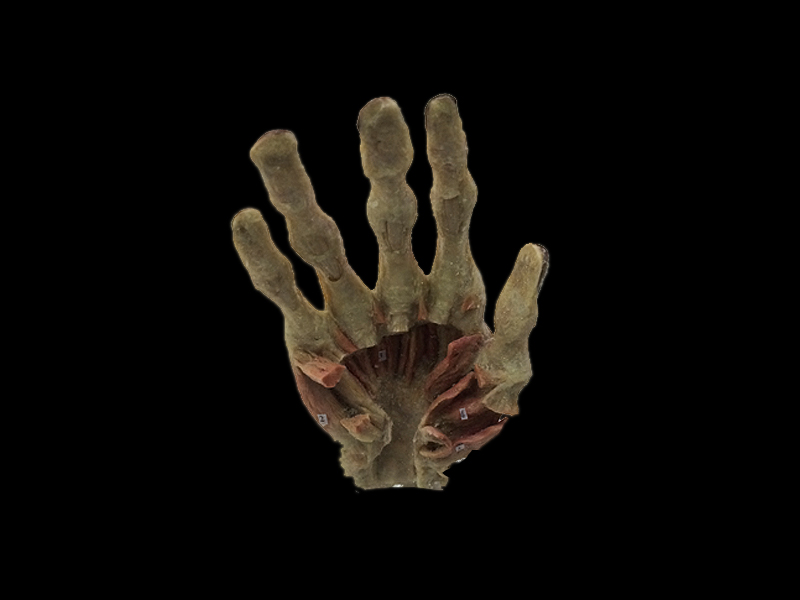 Deep muscles of hand plastinated specimens( plastinates of the human body )