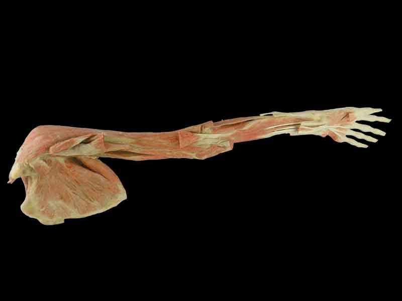 deep muscles of upper limb with shoulder plastination