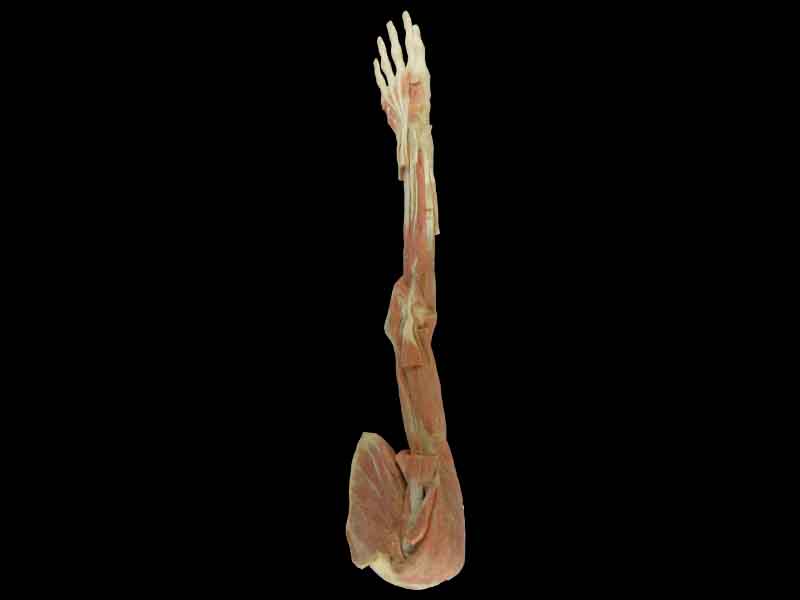 deep muscles of upper limb with shoulder specimen
