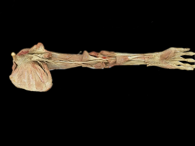 Deep muscles of upper limb plastinated specimens(human plastination  ) 