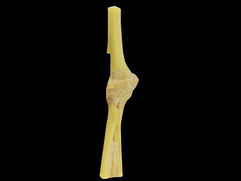 Elbow joint anatomy teaching specimen