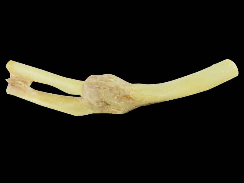 Elbow joint medical specimen