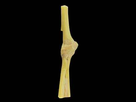 Elbow joint