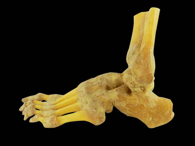 foot joint plastinated specimen