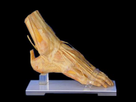 Foot muscles plastinated specimens( plastinated human body )
