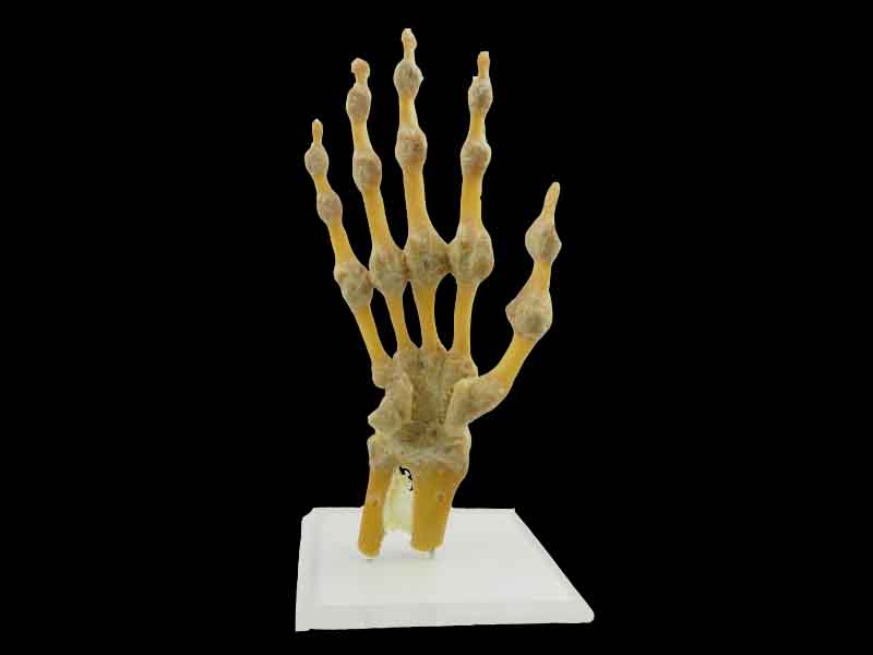 hand joint plastinated specimen