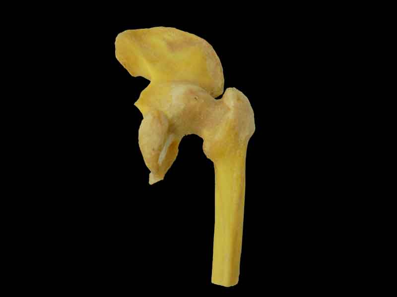 Hip joint