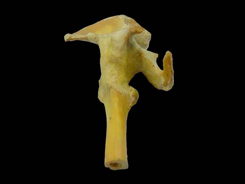 Hip joint medical specimen