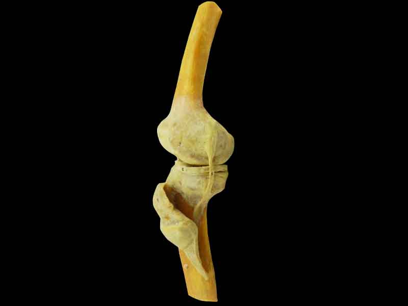 human knee joint specimen