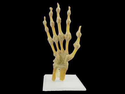 Joints of hand