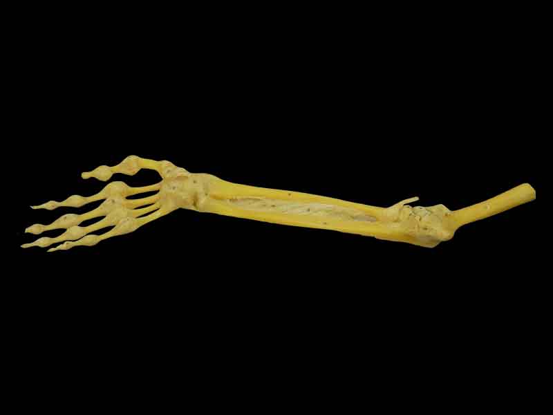 Joints of the upper limb for sale