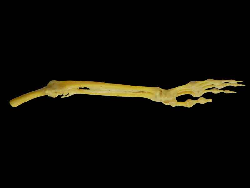 Joints of the upper limb medical specimen