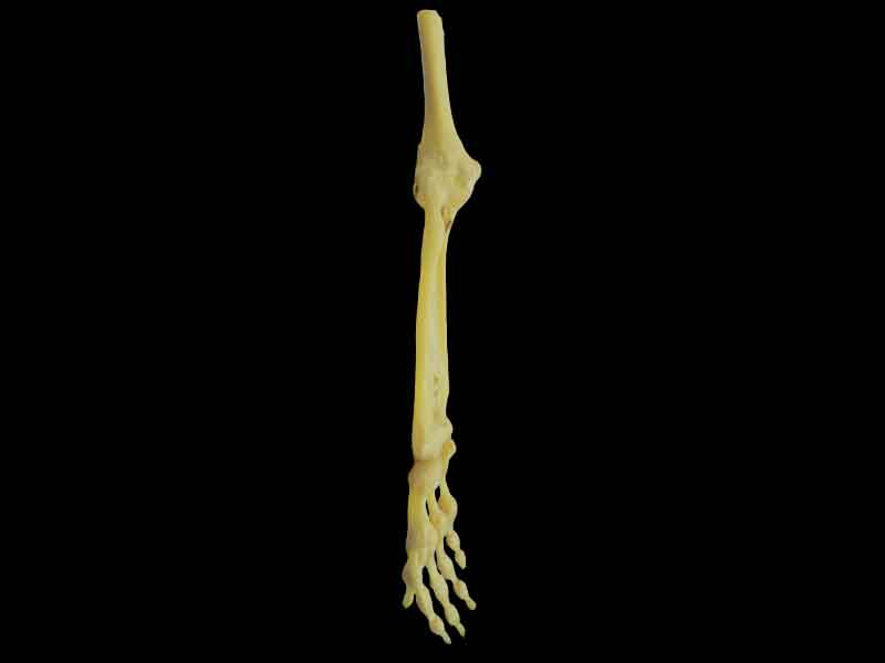 Joints of the upper limb specimen without shoulder