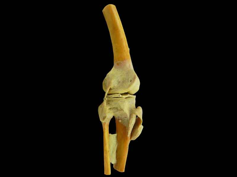 knee joint plastinated specimen