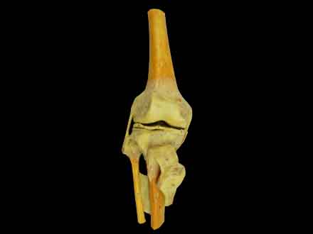 knee joint plastinated specimen