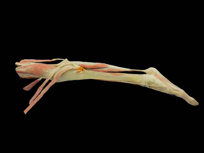 mid thight-foot medical teaching specimen
