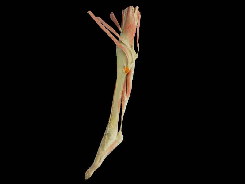 mid thight-foot plastination