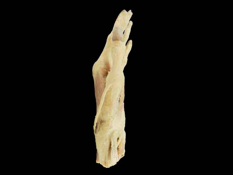 middle muscle of human hand plastinated specimen