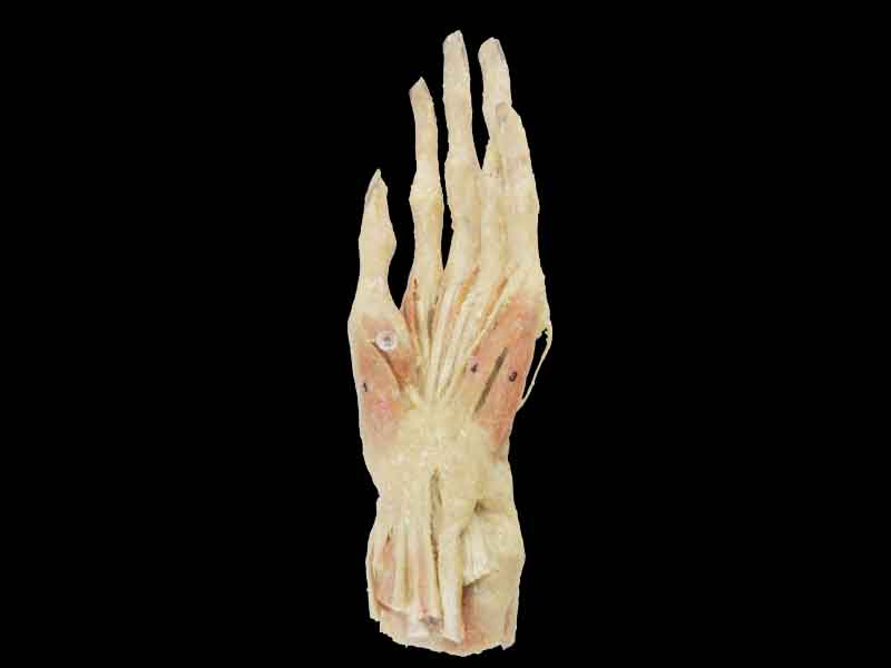 Middle muscles of hand