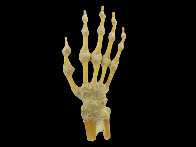 plastinated hand joint specimen
