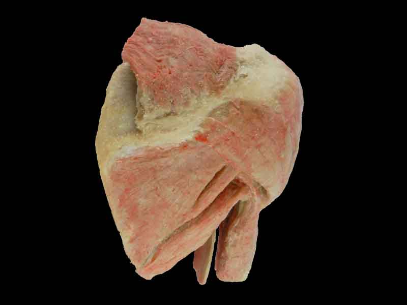 plastinated sagittal section of shoulder joint muscle