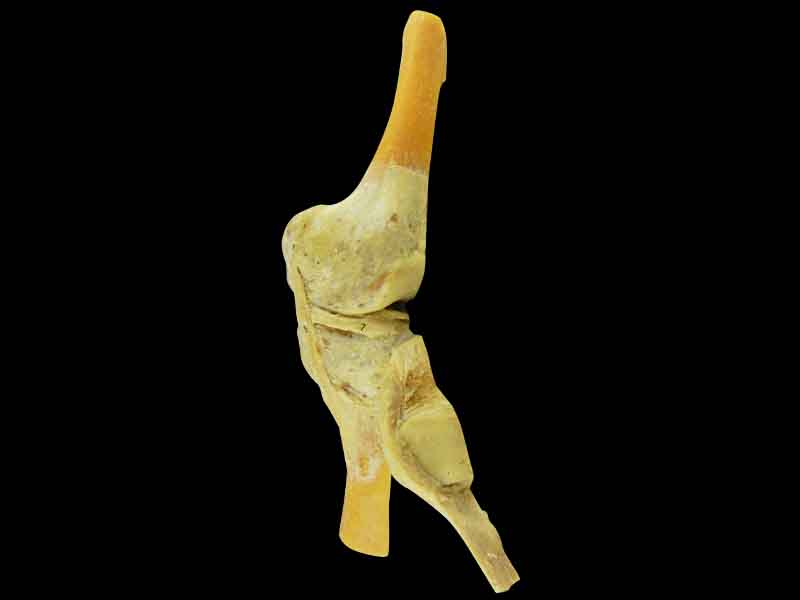 saggital section of human keen joint plastinated specimen