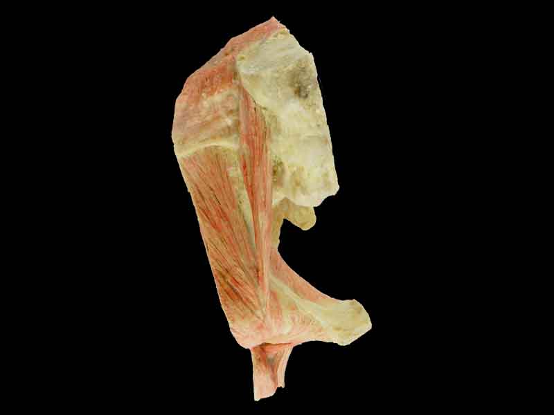 sagittal section of   hip joint for sale