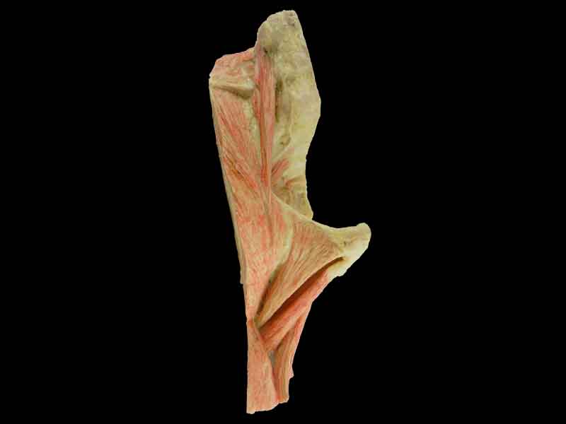 sagittal section of   hip joint plastination