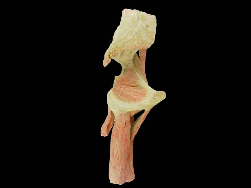sagittal section of   hip joint