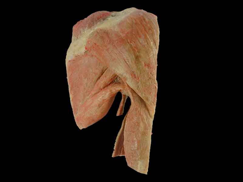 sagittal section of shoulder joint muscle plastinated specimen