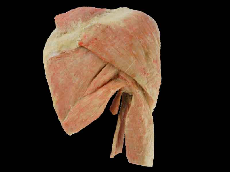 sagittal section of shoulder joint muscle plastination