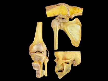 Secondary structure of articulationes synoviales