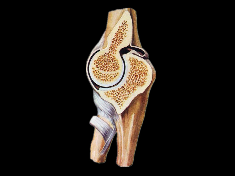 Section of elbow joint plastinated specimens ( plastinates)