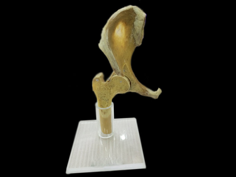 Section of hip joint plastinated specimens  (plastination for sale)