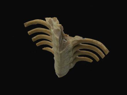 Section of vertebral volumn (plastinated )showing with ligament plastinated specimen