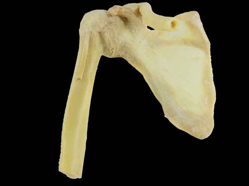 shoulder joint medical specimen