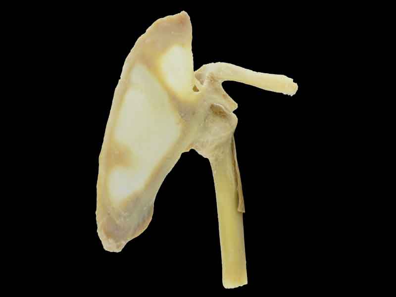 shoulder joint plastinated specimen