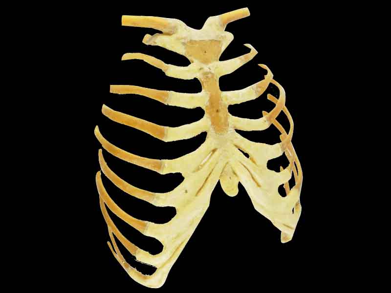 Sternum stemocostal and costochondoral junction plastination