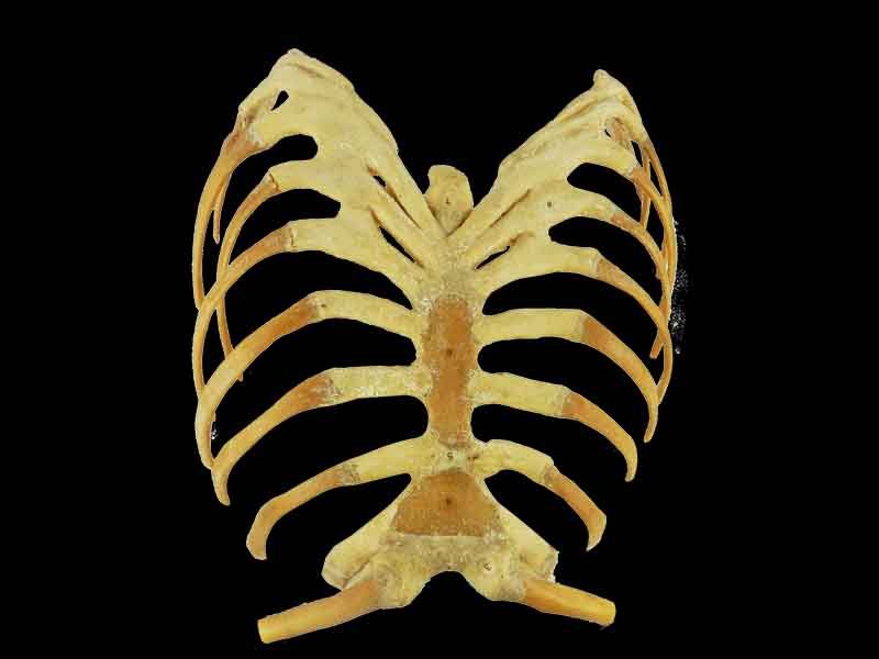 Sternum stemocostal and costochondoral junction