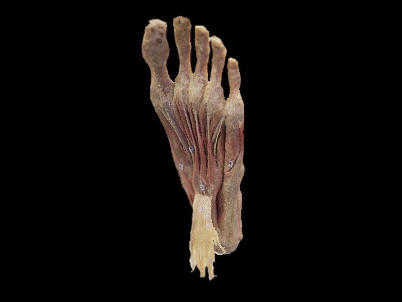Superfical muscles of foot plastinated specimens(plastination ) 