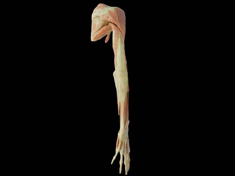 superficial and deep muscles of upper limb plastination