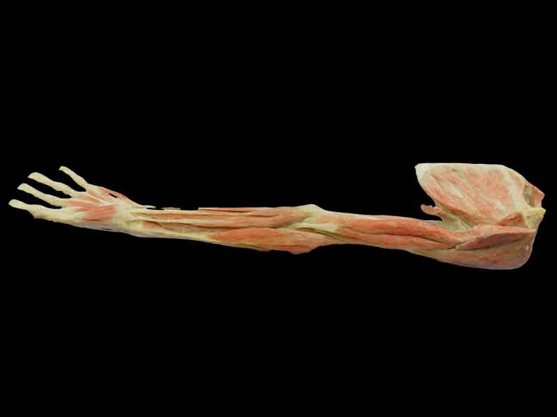 superficial and deep muscles of upper limb specimen